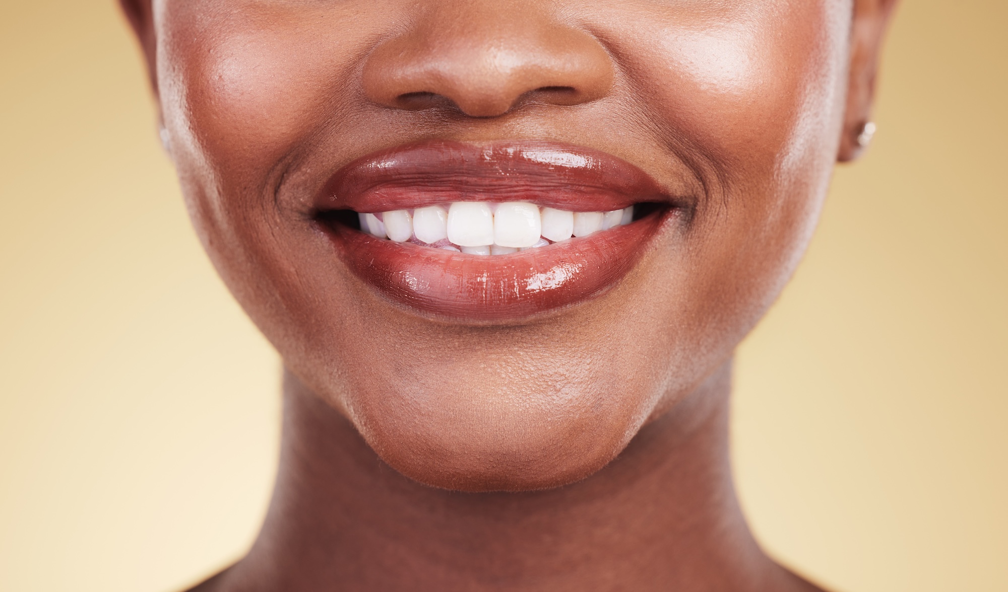 Woman smiling after receiving lip filler near Winter Garden, FL